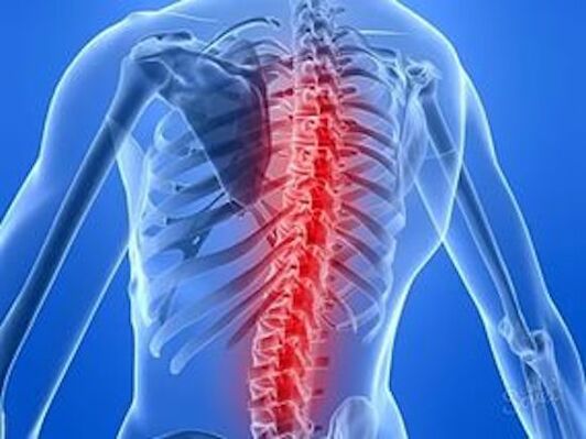 Οι σπονδυλικές διαταραχές προκαλούν πόνο στην πλάτη