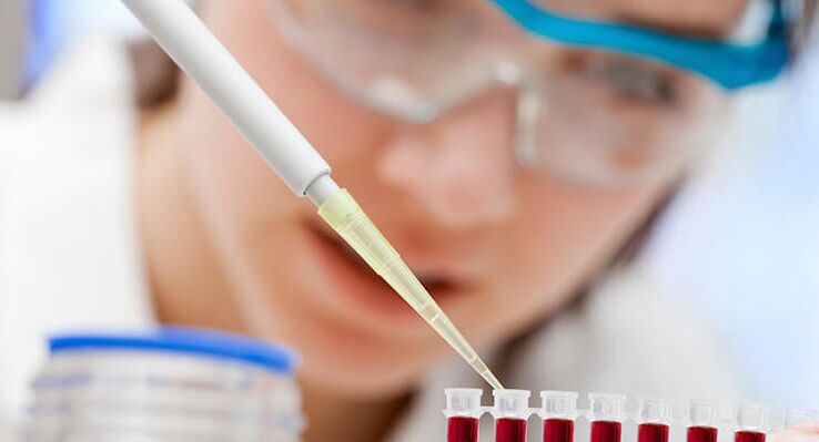 Εξετάσεις αίματος για αρθρίτιδα ισχίου